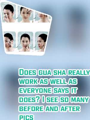 Gua sha stone results